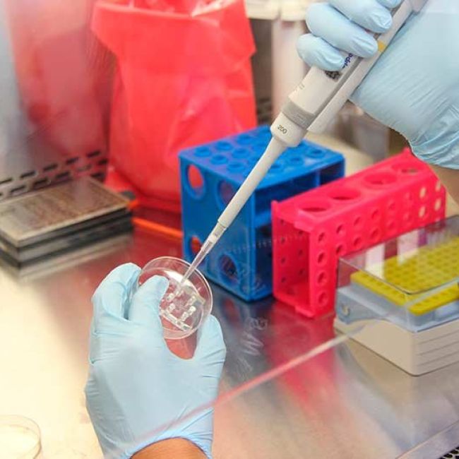 Control de Legionela