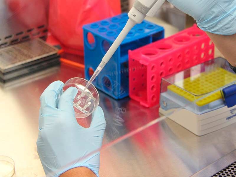 Control de legionela